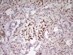 MEF2D Antibody in Immunohistochemistry (Paraffin) (IHC (P))