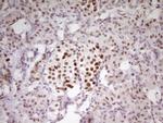 MEF2D Antibody in Immunohistochemistry (Paraffin) (IHC (P))