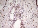 MEF2D Antibody in Immunohistochemistry (Paraffin) (IHC (P))