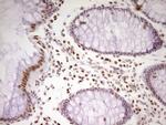 MEF2D Antibody in Immunohistochemistry (Paraffin) (IHC (P))