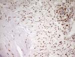 MEF2D Antibody in Immunohistochemistry (Paraffin) (IHC (P))