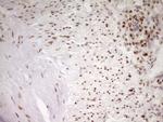 MEF2D Antibody in Immunohistochemistry (Paraffin) (IHC (P))