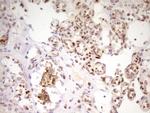 MEF2D Antibody in Immunohistochemistry (Paraffin) (IHC (P))