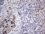 MEIS1 Antibody in Immunohistochemistry (Paraffin) (IHC (P))