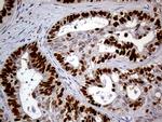 MEIS1 Antibody in Immunohistochemistry (Paraffin) (IHC (P))