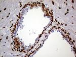 MEIS1 Antibody in Immunohistochemistry (Paraffin) (IHC (P))