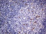 MEIS1 Antibody in Immunohistochemistry (Paraffin) (IHC (P))