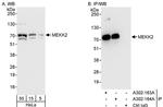 MEKK2 Antibody in Western Blot (WB)