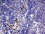 MEOX1 Antibody in Immunohistochemistry (Paraffin) (IHC (P))