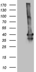 MEOX1 Antibody in Western Blot (WB)