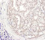 MEPCE Antibody in Immunohistochemistry (IHC)