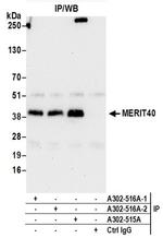 MERIT40 Antibody in Immunoprecipitation (IP)