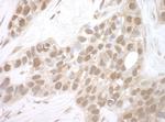 MERIT40 Antibody in Immunohistochemistry (IHC)