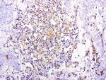 MET Antibody in Immunohistochemistry (Paraffin) (IHC (P))