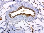 MET Antibody in Immunohistochemistry (Paraffin) (IHC (P))