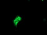 METAP2 Antibody in Immunocytochemistry (ICC/IF)