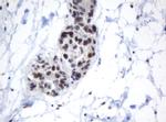 METT10D Antibody in Immunohistochemistry (Paraffin) (IHC (P))