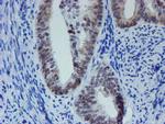 METT10D Antibody in Immunohistochemistry (Paraffin) (IHC (P))