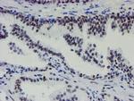 METT10D Antibody in Immunohistochemistry (Paraffin) (IHC (P))