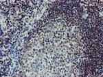 METT10D Antibody in Immunohistochemistry (Paraffin) (IHC (P))