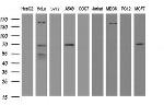 METT10D Antibody in Western Blot (WB)