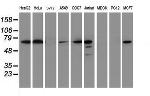 METT10D Antibody in Western Blot (WB)