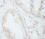 METTL3/MT-A70 Antibody in Immunohistochemistry (IHC)