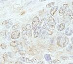 METTL3/MT-A70 Antibody in Immunohistochemistry (IHC)