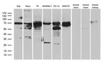 METTL3 Antibody in Western Blot (WB)