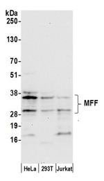 MFF Antibody in Western Blot (WB)