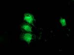 MGLL Antibody in Immunocytochemistry (ICC/IF)