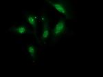 MGLL Antibody in Immunocytochemistry (ICC/IF)