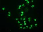 MGLL Antibody in Immunocytochemistry (ICC/IF)