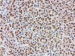 MGLL Antibody in Immunohistochemistry (Paraffin) (IHC (P))