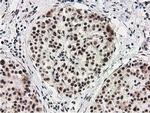 MGLL Antibody in Immunohistochemistry (Paraffin) (IHC (P))