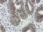 MGLL Antibody in Immunohistochemistry (Paraffin) (IHC (P))