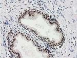 MGLL Antibody in Immunohistochemistry (Paraffin) (IHC (P))