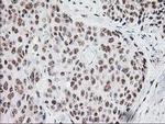 MGLL Antibody in Immunohistochemistry (Paraffin) (IHC (P))