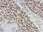 MGLL Antibody in Immunohistochemistry (Paraffin) (IHC (P))