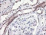 MGLL Antibody in Immunohistochemistry (Paraffin) (IHC (P))