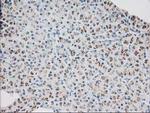 MGLL Antibody in Immunohistochemistry (Paraffin) (IHC (P))