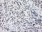 MGLL Antibody in Immunohistochemistry (Paraffin) (IHC (P))