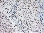 MGLL Antibody in Immunohistochemistry (Paraffin) (IHC (P))