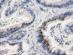 MGLL Antibody in Immunohistochemistry (Paraffin) (IHC (P))