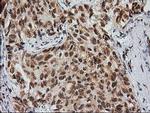 MGLL Antibody in Immunohistochemistry (Paraffin) (IHC (P))