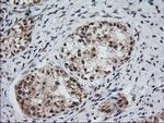 MGLL Antibody in Immunohistochemistry (Paraffin) (IHC (P))