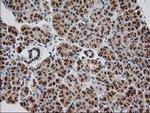 MGLL Antibody in Immunohistochemistry (Paraffin) (IHC (P))