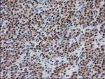 MGLL Antibody in Immunohistochemistry (Paraffin) (IHC (P))