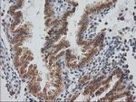 MGLL Antibody in Immunohistochemistry (Paraffin) (IHC (P))