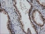 MGLL Antibody in Immunohistochemistry (Paraffin) (IHC (P))